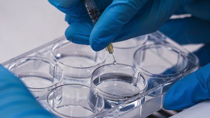 İzmir'de geliştirilen "yara örtüsü" kronik yaralar için umut olacak